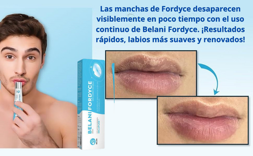 Belani-Fordyce